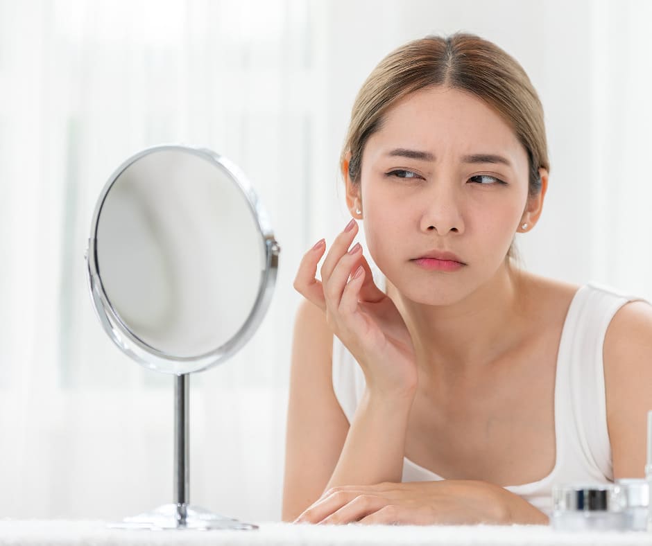 5 ingredientes para calmar los brotes de acné - Sokobox