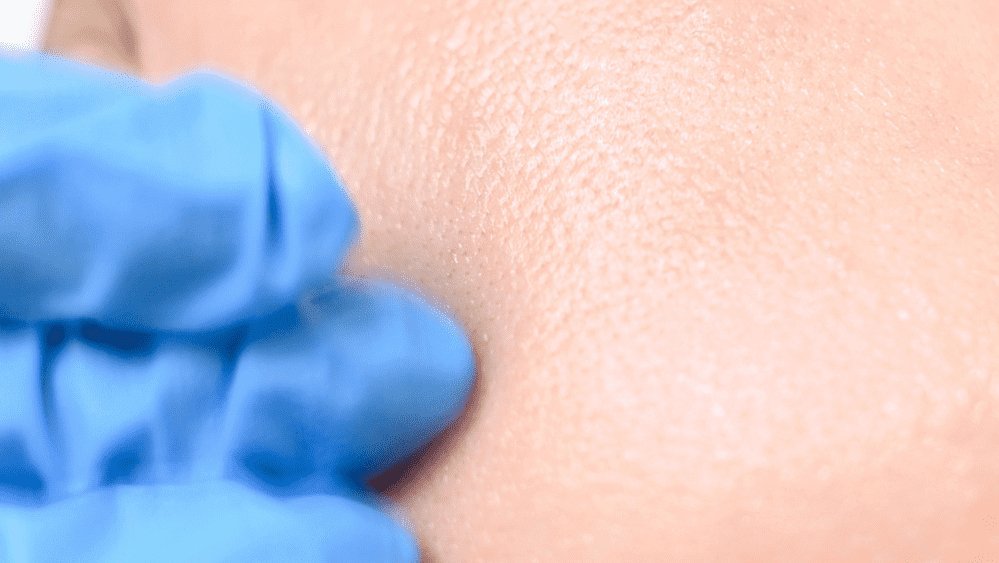 Poros: ¿Qué son y por qué existen en la piel? - Sokobox