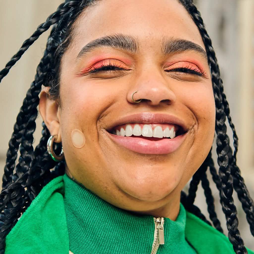 Micropoints for Blemishes