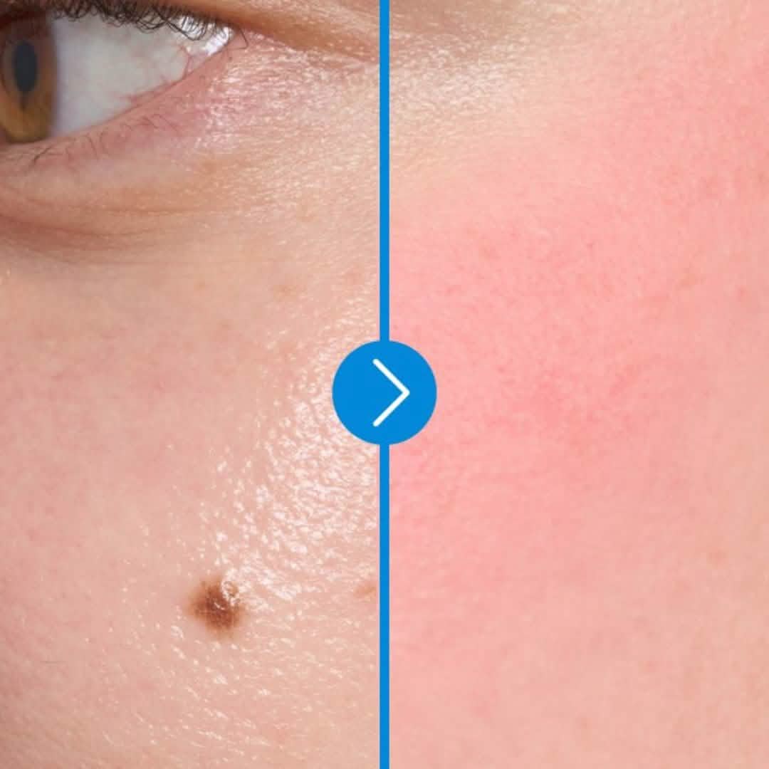 Keyring Lip&Cheek Blurry Pudding Pot MV05 Boss