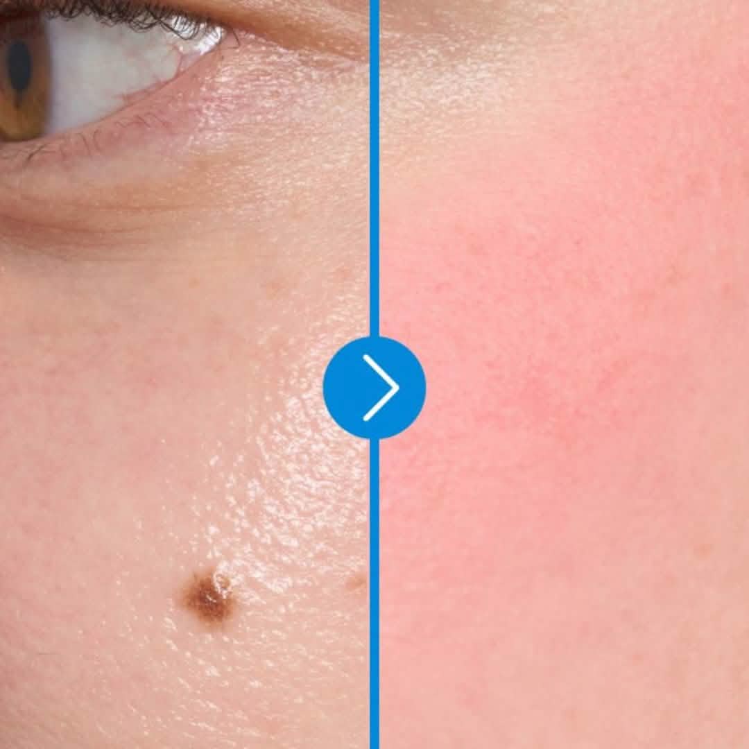 Keyring Lip&Cheek Blurry Pudding Pot RS04 Memories