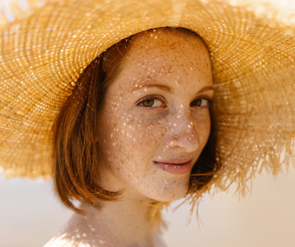 Previene y trata las manchitas todo el año! Tips para una iluminación efectiva - Sokobox