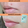 Parche Hidrocoloide | (Box) Hydrocolloid for Blemishes - Sokobox