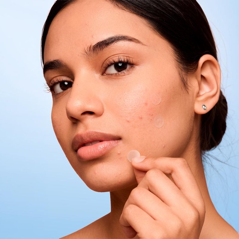 Parche Hidrocoloide | Hydrocolloid for Blemishes - Sokobox
